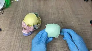 Теменная кость