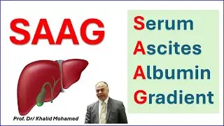 SAAG (serum-ascites albumin gradient)