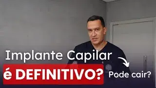 Transplante Capilar é a SOLUÇÃO DEFINITIVA para CALVÍCIE?