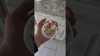 Bladder stones
