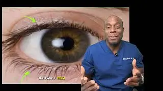 Eyelid Twitches: Common Causes