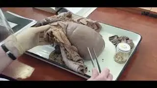 Jigar     Печень    Liver