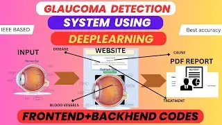 Glaucoma Detection Using Deep Learning | IEEE Final Year Project with Code, Docs & Mentorship