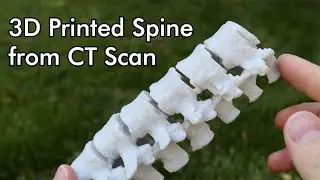 3D Printed Spine from a CT Scan