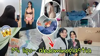 Abdominoplastia y más !!!! preparación, costos, etc  Pt1