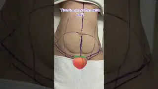 Getting rid of a  front butt  