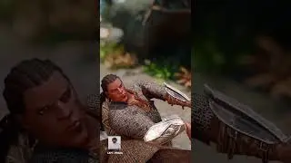 SKYRIM'S REALISTIC BURN DAMAGE 