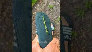 This wasnt easy to get out of my foot! 🦶