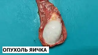 Яичко - анатомия и гистологическое исследование препарата