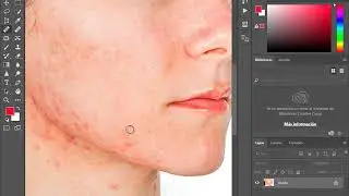Photoshop Herramienta Pincel Corrector Puntual