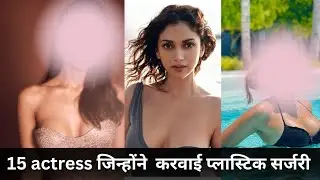 15 अभिनेत्री जिन्होंने खूबसूरत दिखने के लिए किया प्लास्टिक सर्जरी।15 actress who did plastic surgery
