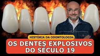 História da Odontologia: A Curiosa História dos Dentes Explosivos