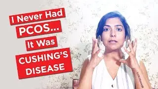 I Never Had PCOS... It Was Cushing's Disease / Cushing's Syndrome 
