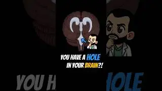 The HOLES in Your BRAIN #shorts