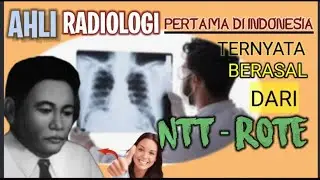 AHLI RADIOLOGI PERTAMA di INDONESIA !! DARI NTT - ROTE // W. Z JOHANNES
