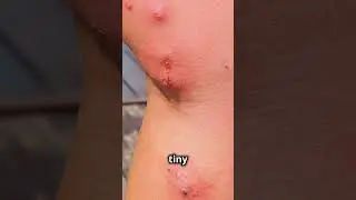 3 World’s Deadliest Insects: Fire Ant, Mosquito, Asian Hornet (Watch Full Video!) 世界三大之最: 致命昆虫 (快闪）