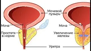 Предстательная железа размеры норма у взрослых
