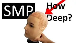 Scalp Skin Thickness for SMP (How Deep)