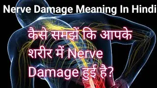 Nerve Damage Meaning In Hindi | कैसे समझें कि आपको Nerve Damage हुई है?