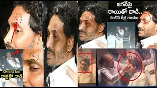 Andhra Pradesh CM YS Jagan Reddy Injured - Jagan Mohan Reddy Attack