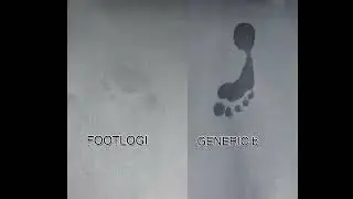 FOOTLOGIX Callus Softener VS Generic Callus Product.