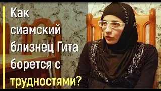 Как сиамский близнец Гита борется с трудностями?