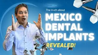 The shocking truth behind Mexico dental prices REVEALED