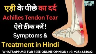 एड़ी के पीछे का दर्द, Achilles Tendon Tear ऐसे ठीक करें, Symptoms & Treatment in Hindi, 
