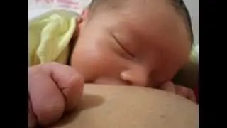 Laringomalácia em Bebês - o que você precisa saber