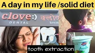 A day in my life | dentist visit | tooth extraction | solid diet | limitlessbymonica