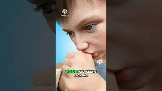 What Does Thumb Sucking Do to kids Teeth 😮  