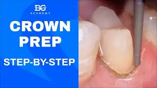 Premolar crown prep: direct and indirect vision