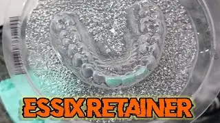 Essix retainer #idst #bds #mds #neet