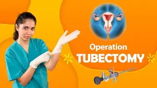 tubectomy operation l tubectomy after pregnancy
