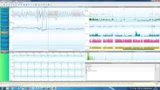KTR2 obzor