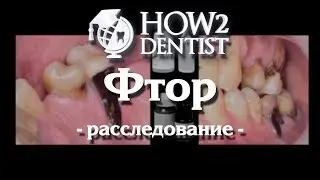 Как фтор работает против кариеса / How to Dentist