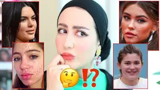 ليش انا مش جميله مثل المشاهير ؟ 😔💔 ( لازم تعرفوا الحقيقه ) ✋🏻‼️|| شهد ناصر 🌸