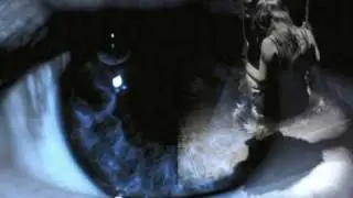 Cephalgy - Du