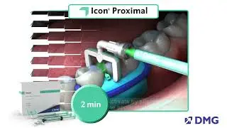 DMG Icon Proximal - Treatment Steps