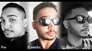 TUTORIAL PEMAKAIAN MINOXIDIL YANG BENAR UNTUK BREWOKAN