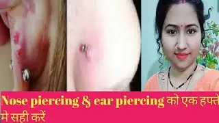 💞How to reduce nose piercing & ear piercing bump in one week💞नाक और कान को घरेलू नुस्खे से ठीक करें