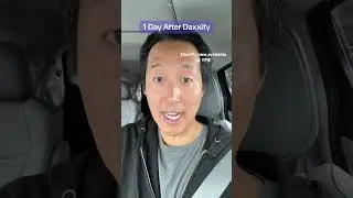 Testing Daxxify- the New Longer Lasting Botox Alternative! 
