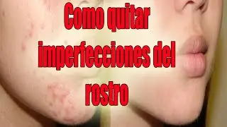 PhotoShop Cs6 - Como Quitar Imperfecciones (Acné, Cicatrices, etc..)