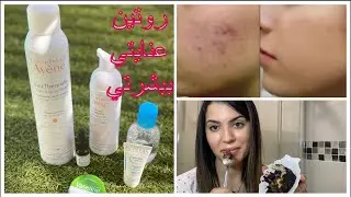 Ma routine visage ÉTÉ : Objectif Peau Parfaite ✨✨روتيني المسائي للحصول على بشرة صافية ضد البقع