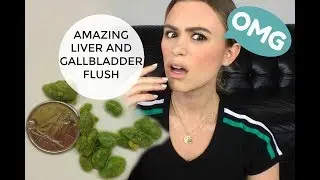 AMAZING LIVER AND GALLBLADDER FLUSH EXPERIENCE *With pictures*