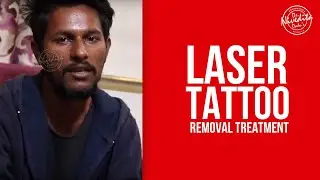 Patient Testimonial | Happy Patients | Best Tattoo Removal Clinic in Delhi