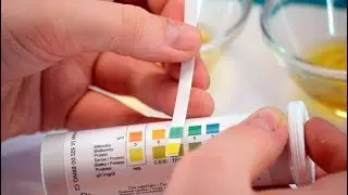 Ацетонемия – что это