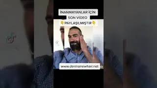 SAÇ ÇIKARTAN LOSYON