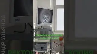 Больно ли это? Ректороманоскопия #проктолог #доктор #геморрой #shorts #ректороманоскопия #эндоскопия