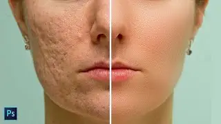 Face Smooth In Photoshop   Easy Frequency Separation Tutorial